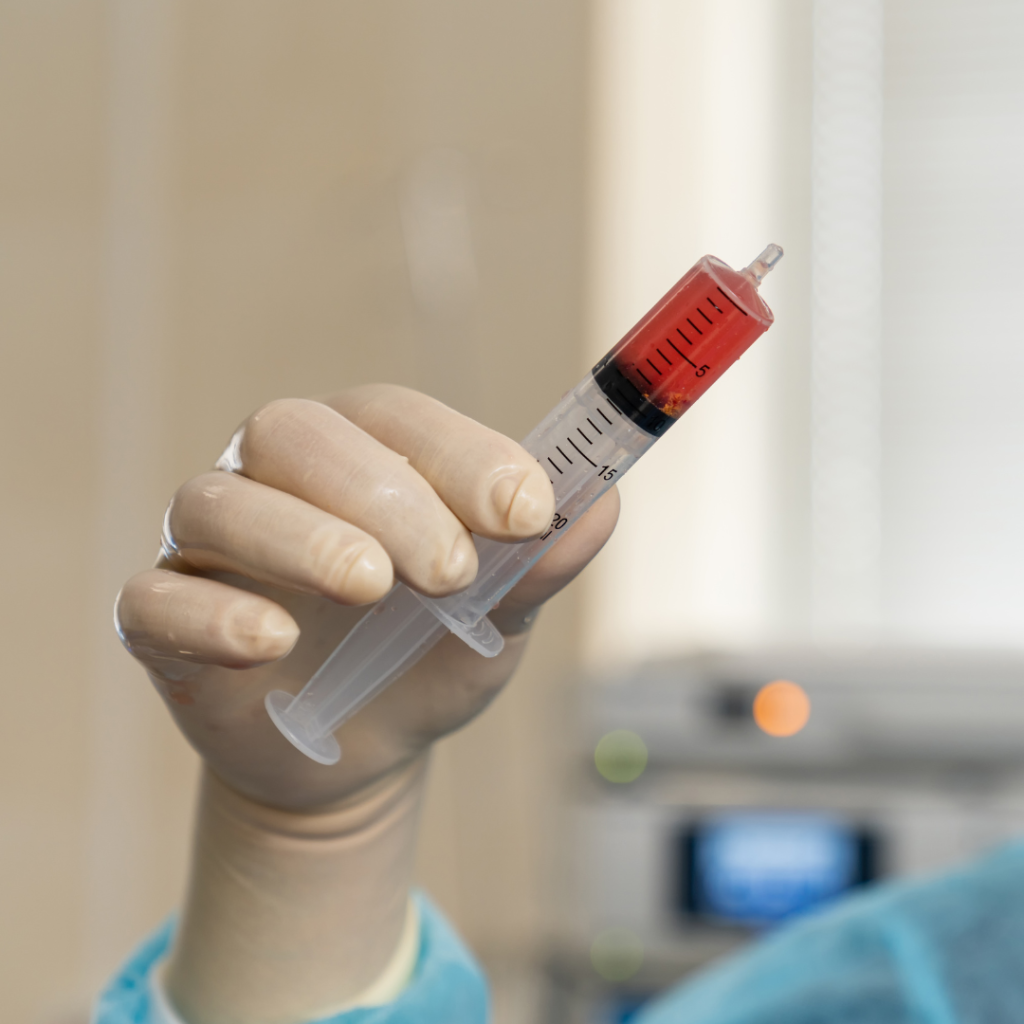 Medula Ossea - Tratamento Oncologico - Liminar Ação Plano de Saúde - Jose Guimas