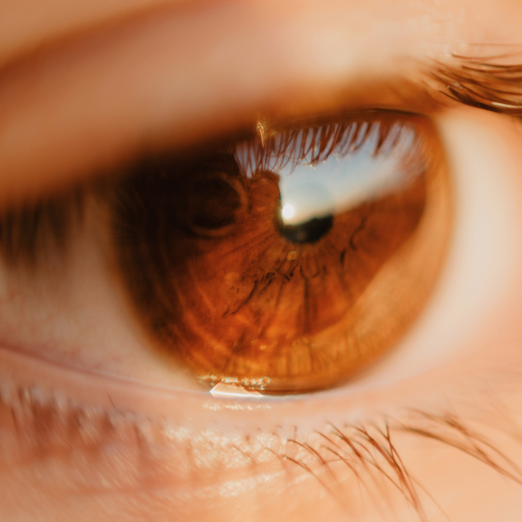 Planos de Saúde Negam o Aflibercepte (Eylia)