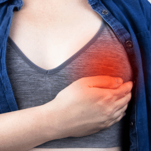 Tratamento Cancer Mama